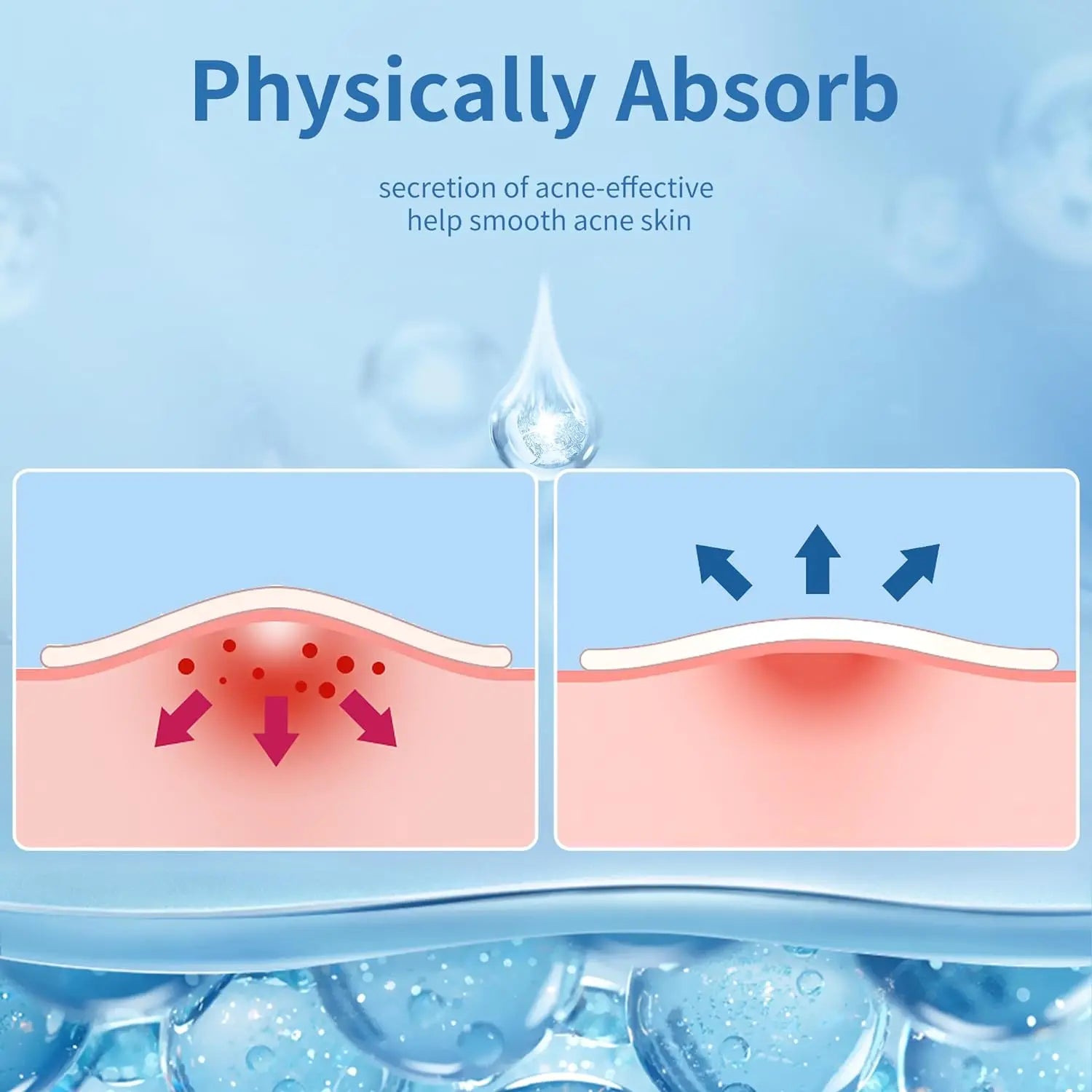 720 PCS Acne Patches Hydrocolloid Round 360/540 PCS Acne Patches !